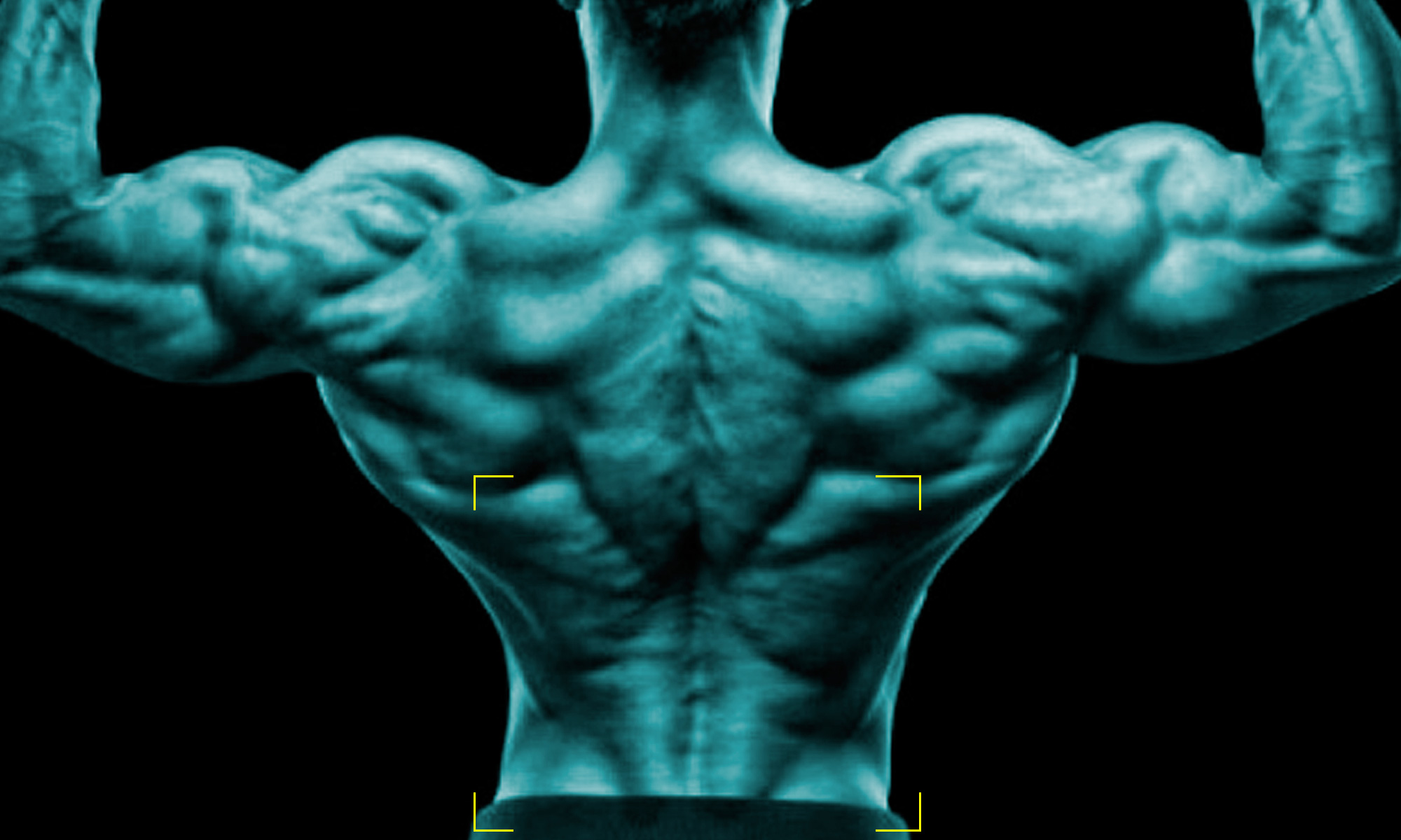 ADI S A LA GRASA LUMBAR MTX Corporation